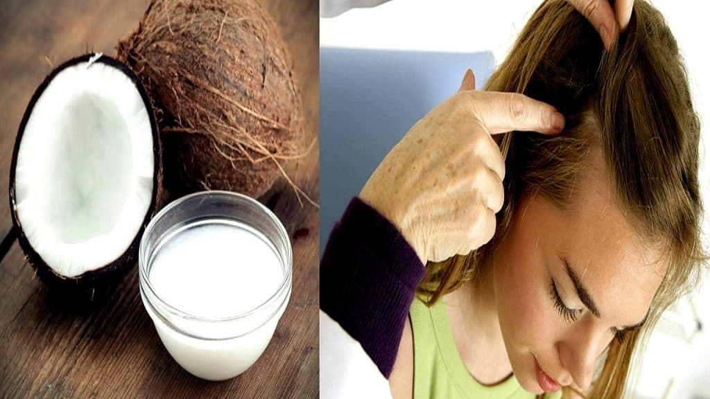 Can Coconut Oil Treat Scalp Psoriasis? Healthy Living Daily