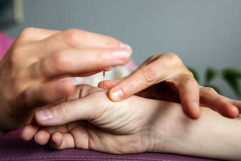 Neuropathy
Acupuncture
Medications