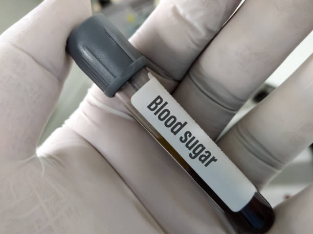 Blood-Sugar-001-02-1 Technician or scientist hold a sample tube of RBS (Random Blood Sugar) test, diagnosis for hyperglycemia or hypoglycemia in Diabetes Mellitus (DM).Medical testing concept